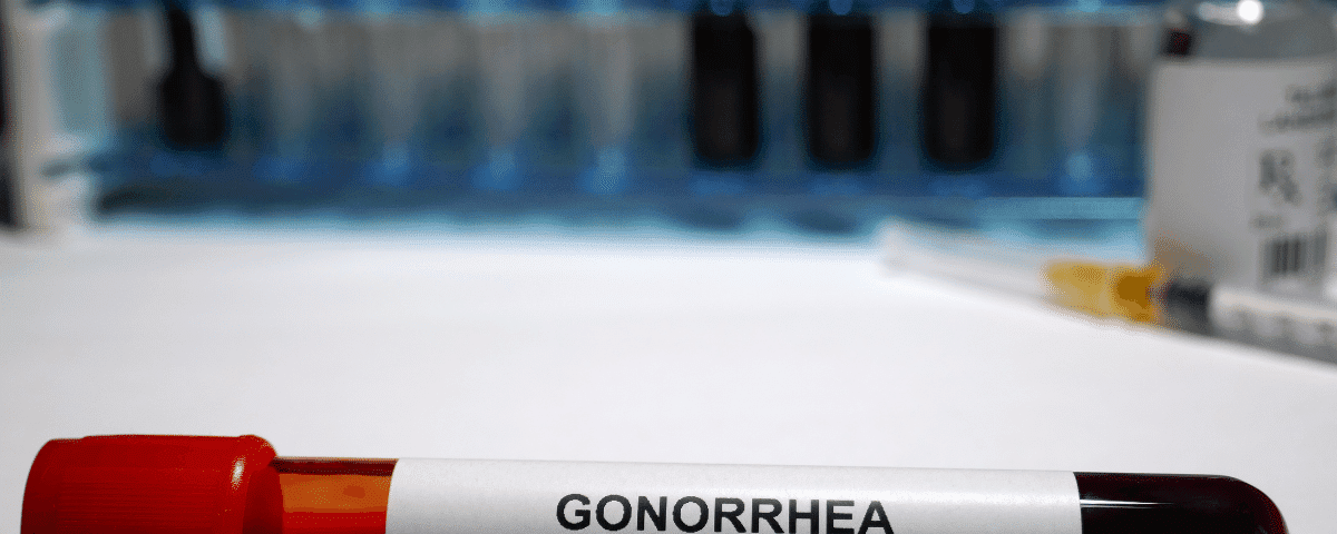 What You Should know About Gonorrhea Infection In Both Gender